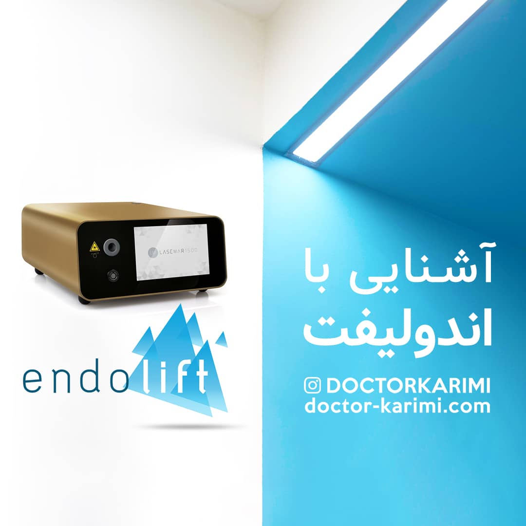 introduction to Endolift by Dr. Maryam Karimi