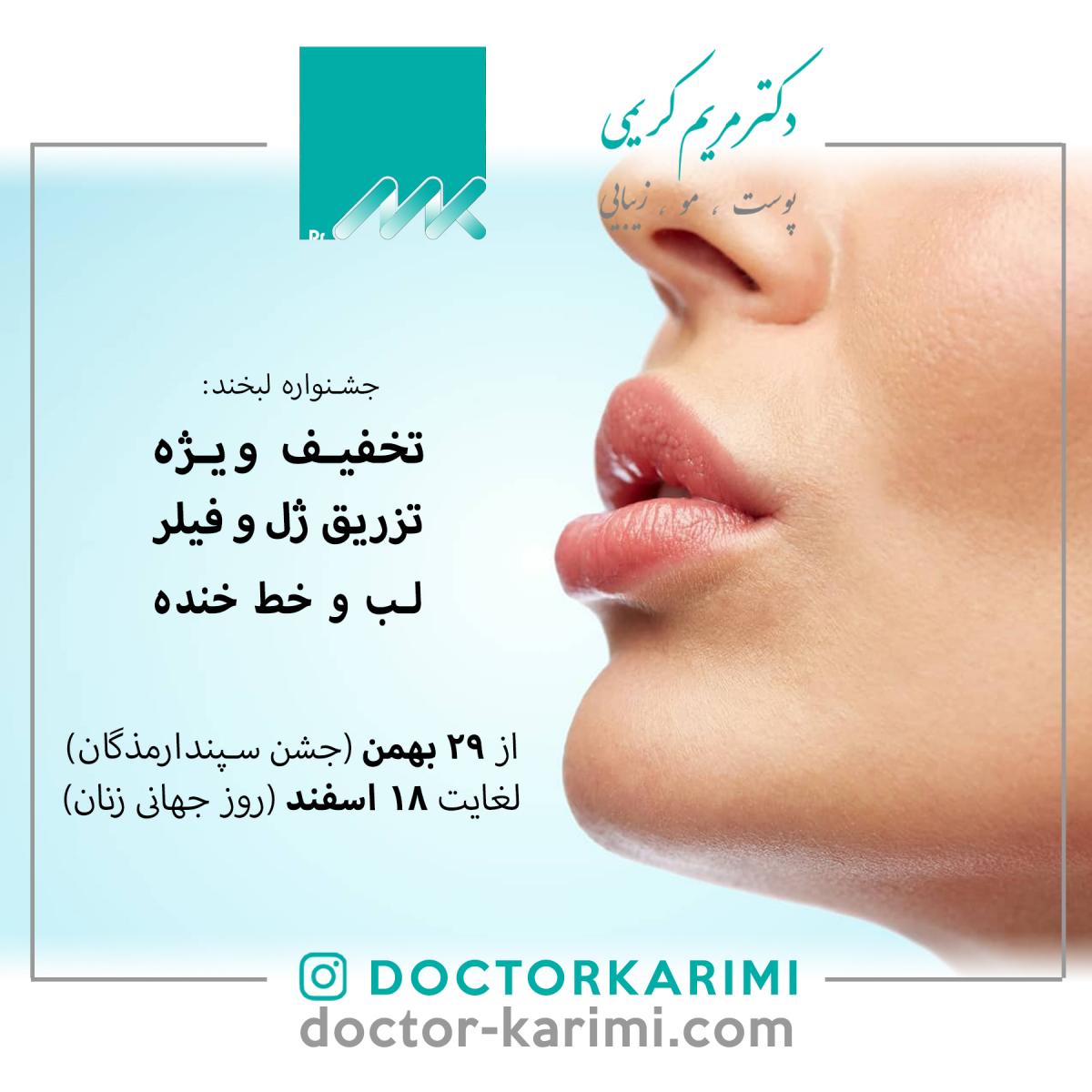 Lips and Smileline filler injection