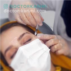 Botox Aftercare precautions
