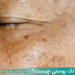 Hyperpigmentation & Dark Spots Treatments